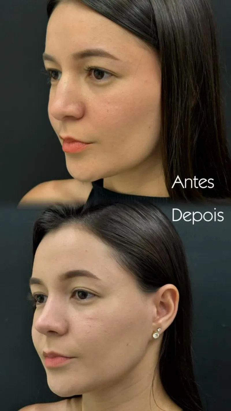 Before and after — Dr. Bruno Laughton
