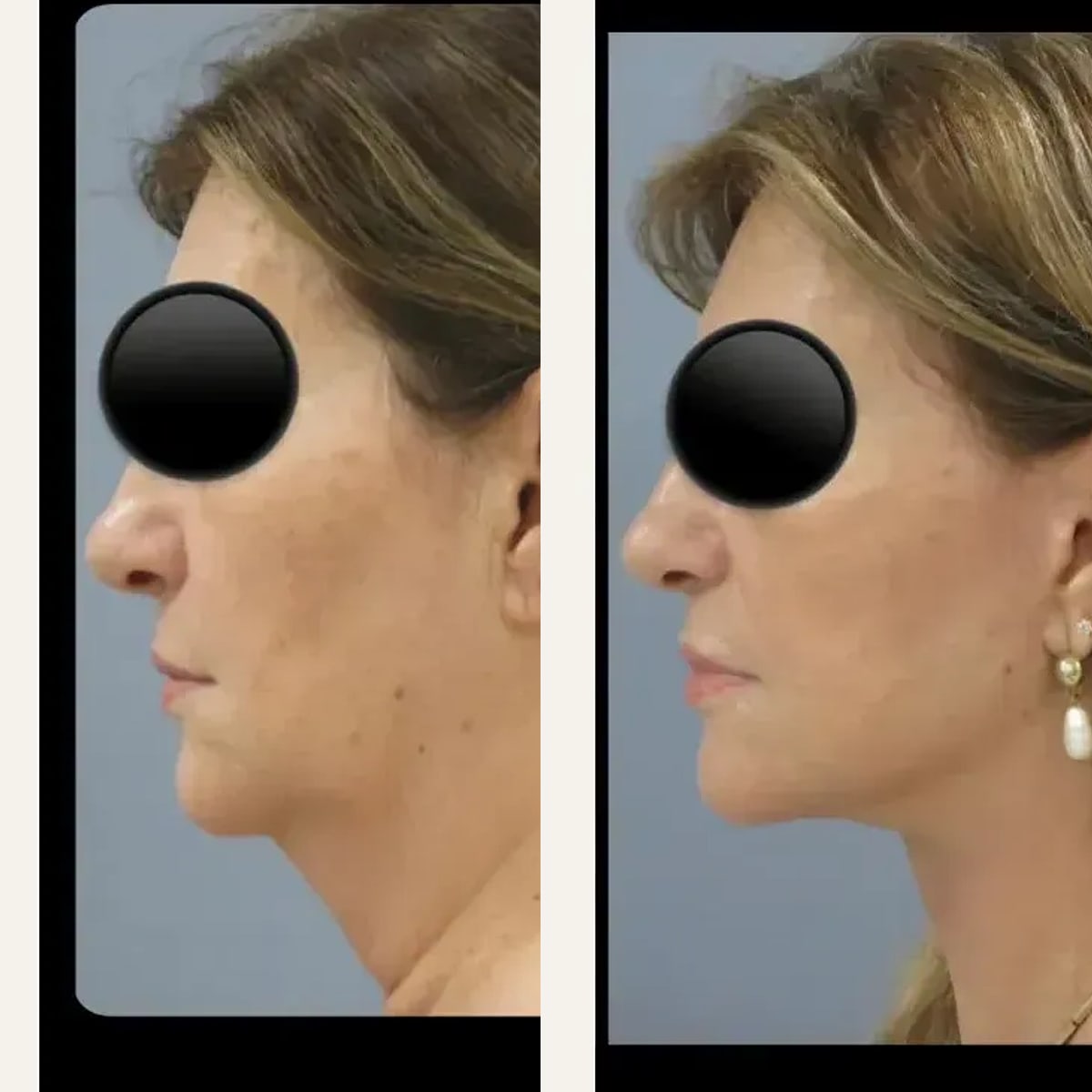 Before and after: Dr. Bruno Onishi