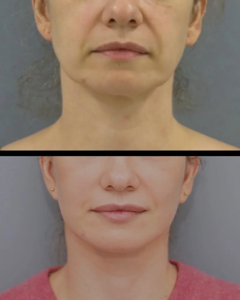 Before and after: Dr. Bruno Onishi