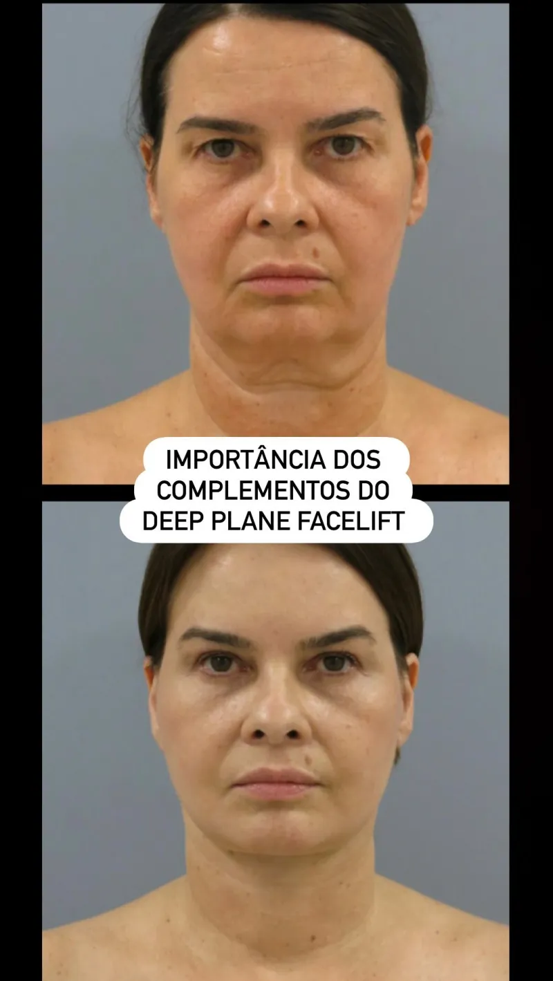 Before and after: Dr. Bruno Onishi