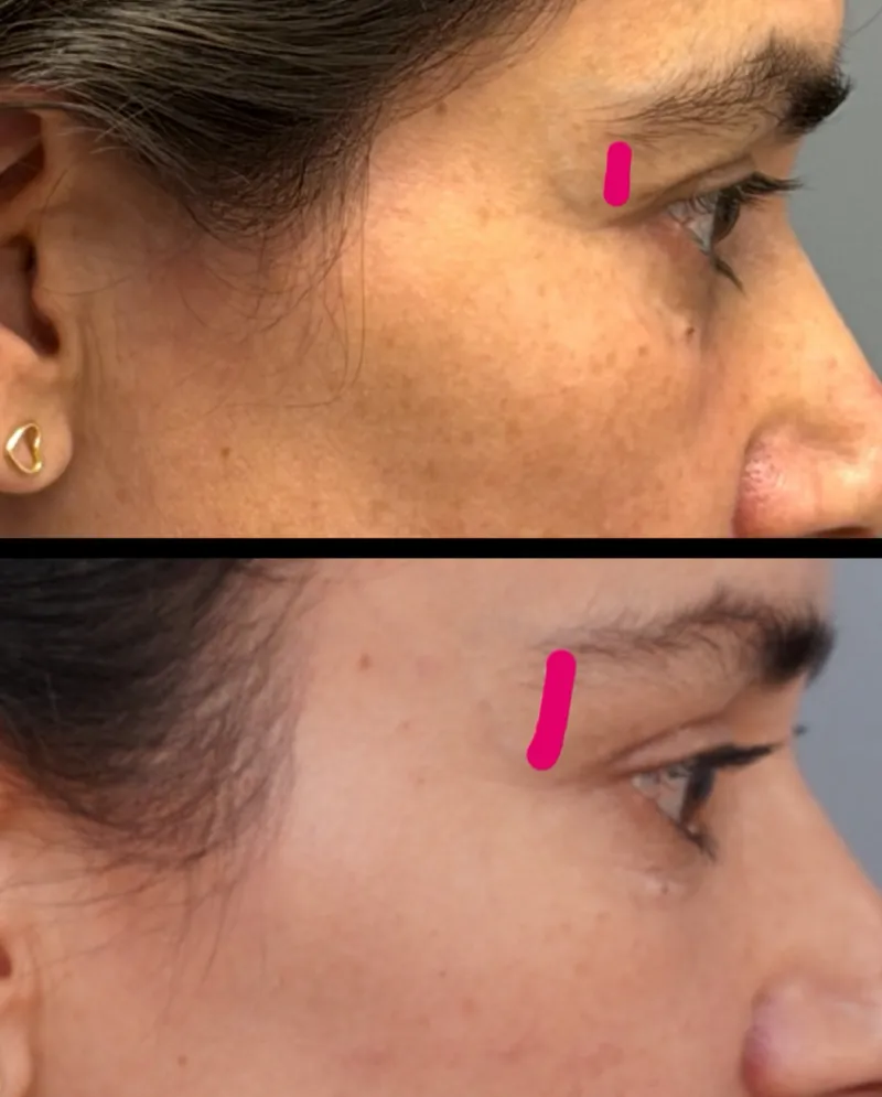 Before and after: Dr. Bruno Onishi