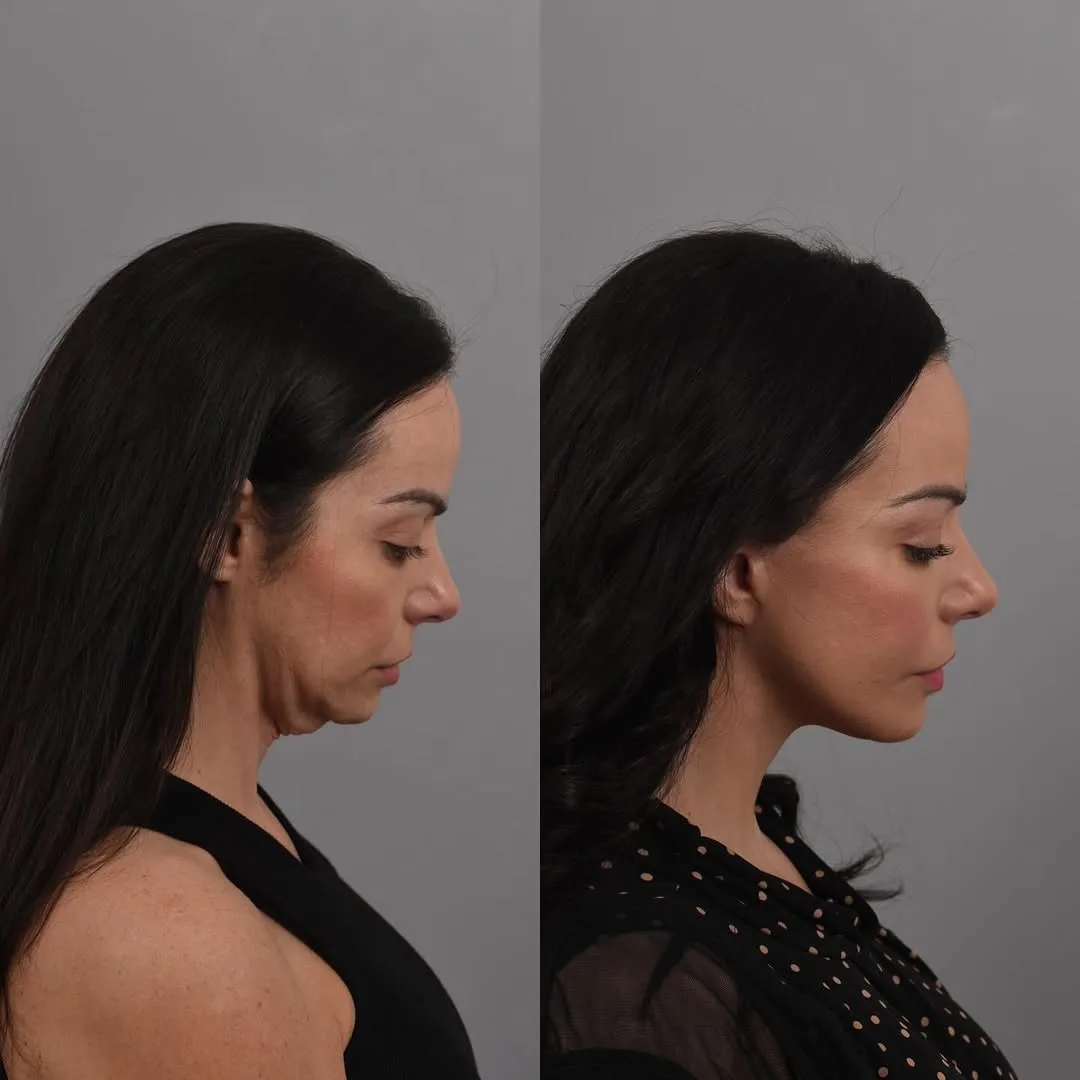Before and after — Dr. Bryan Brandon