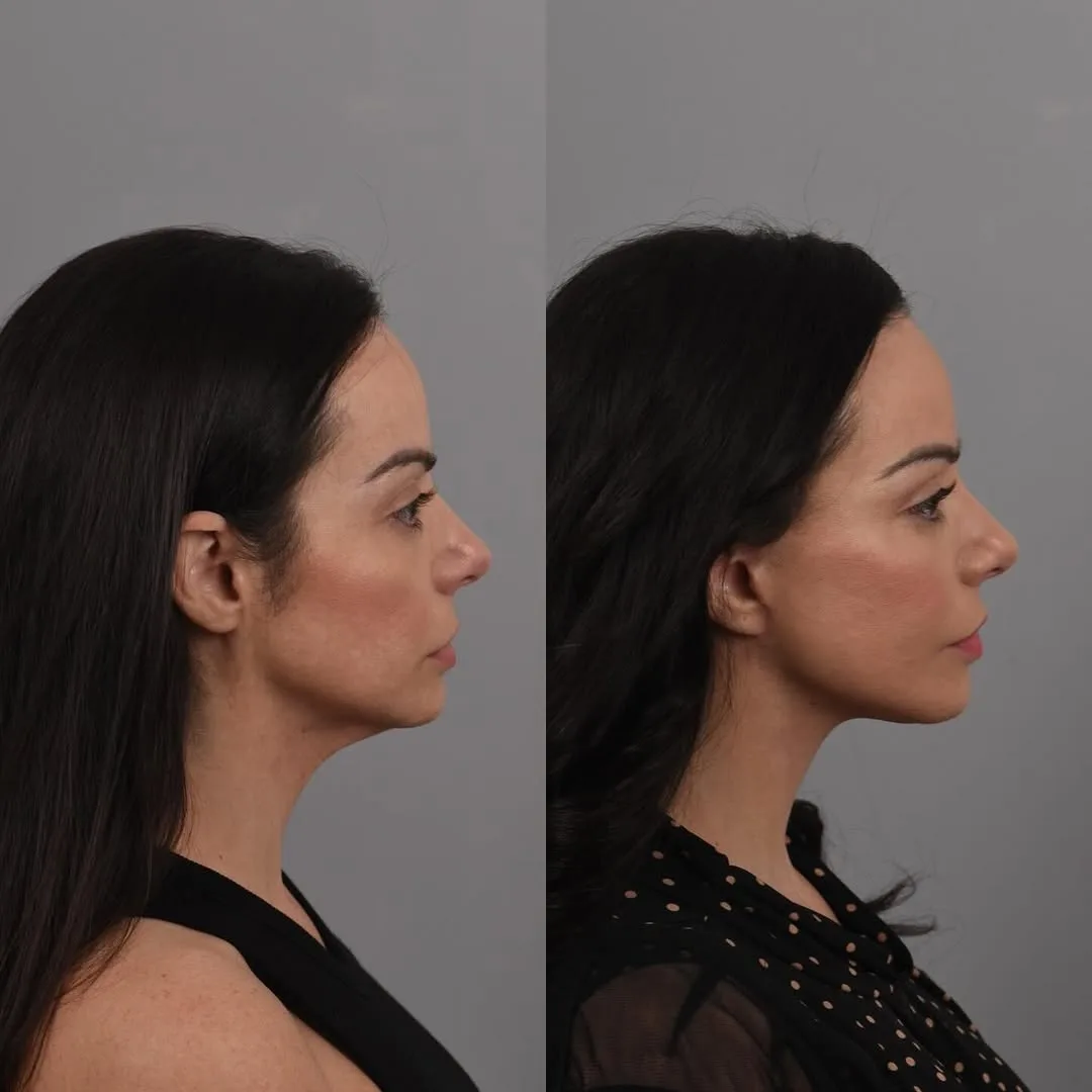 Before and after — Dr. Bryan Brandon