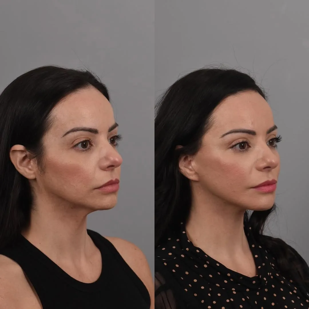 Before and after — Dr. Bryan Brandon