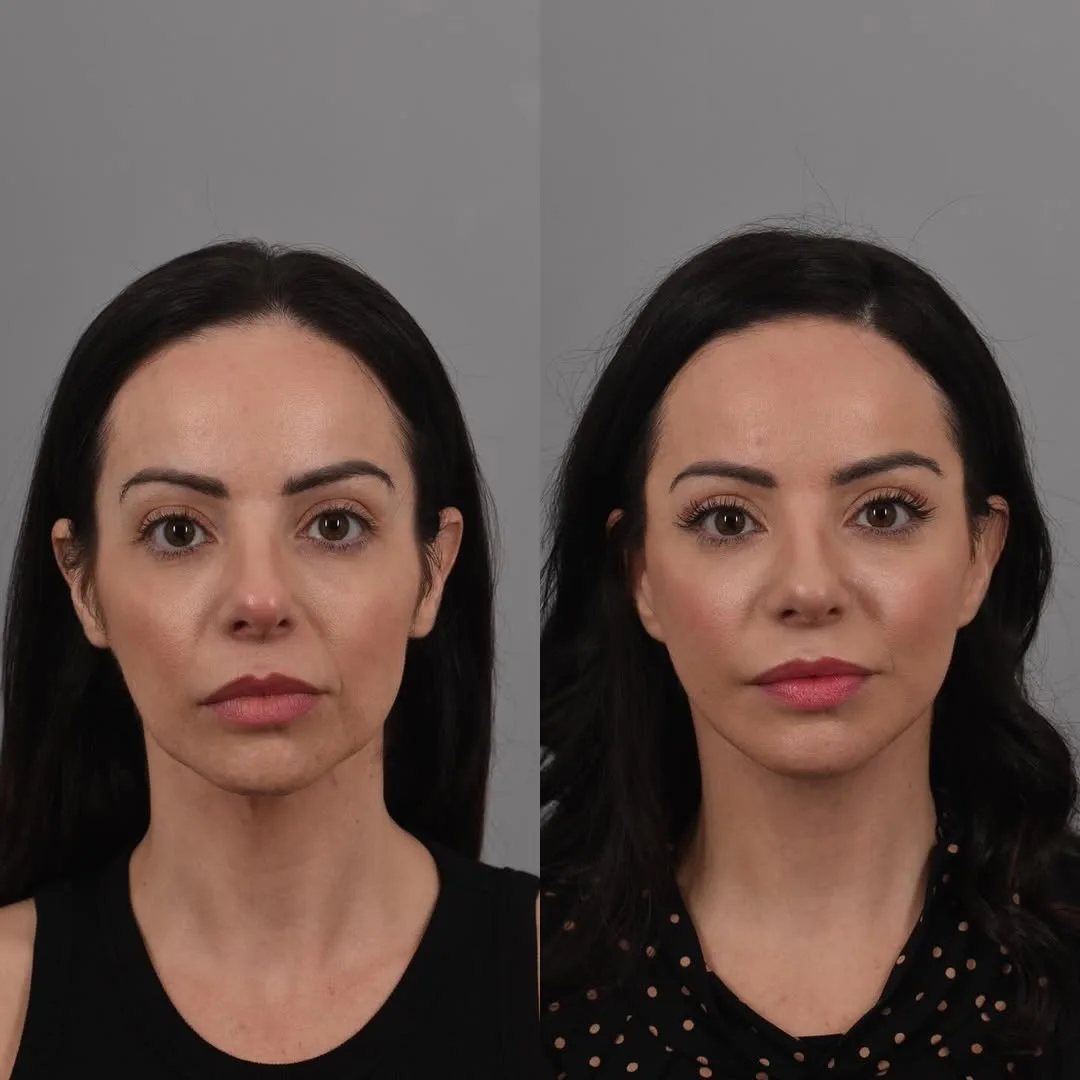 Before and after — Dr. Bryan Brandon