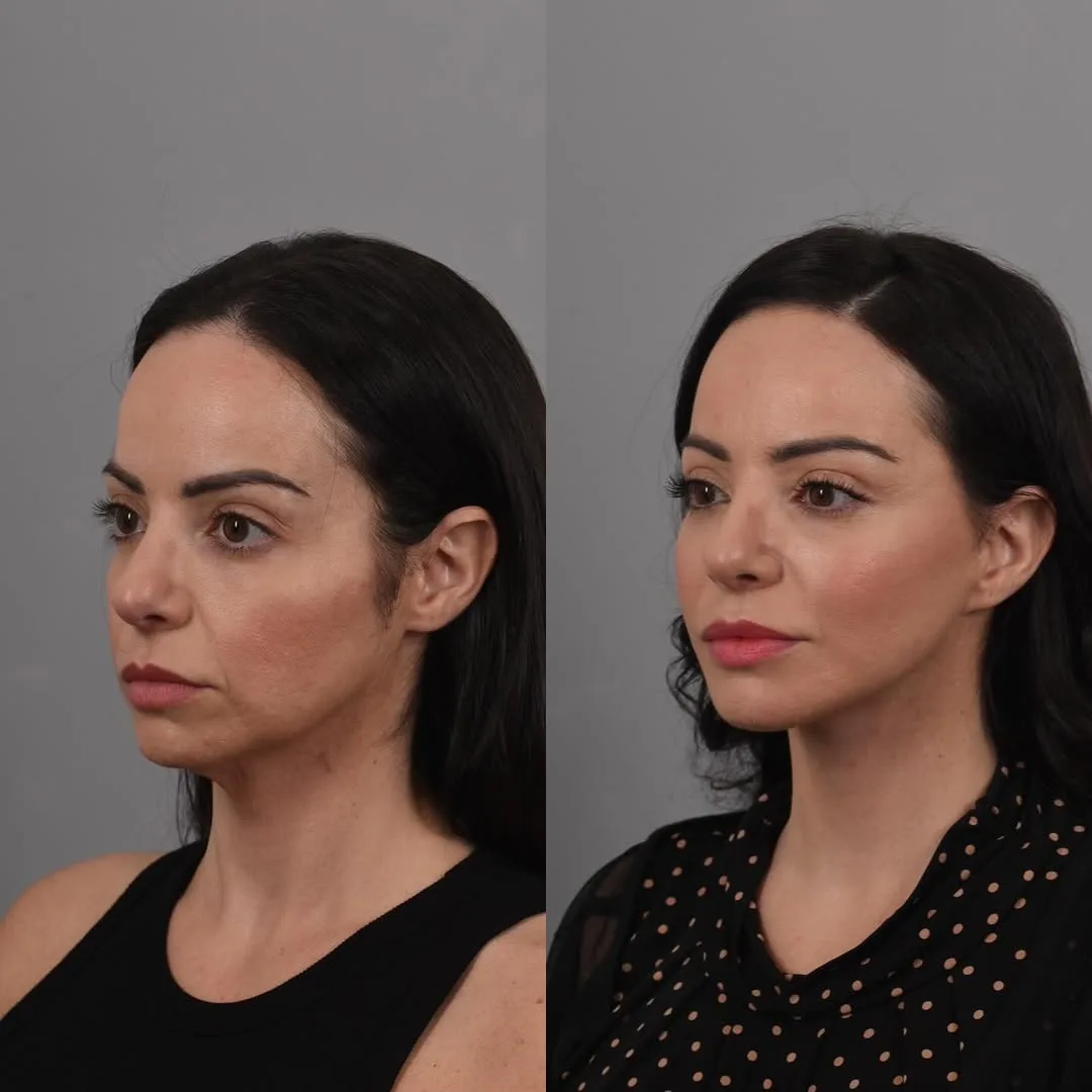 Before and after — Dr. Bryan Brandon