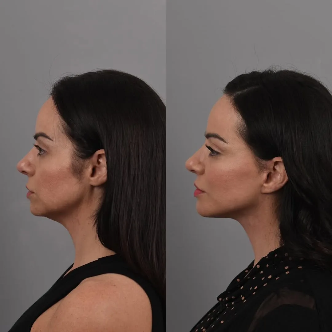 Before and after — Dr. Bryan Brandon