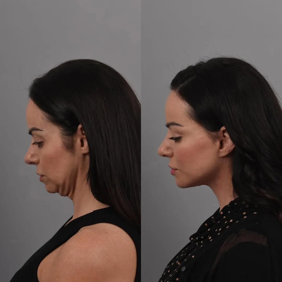 Before and after — Dr. Bryan Brandon