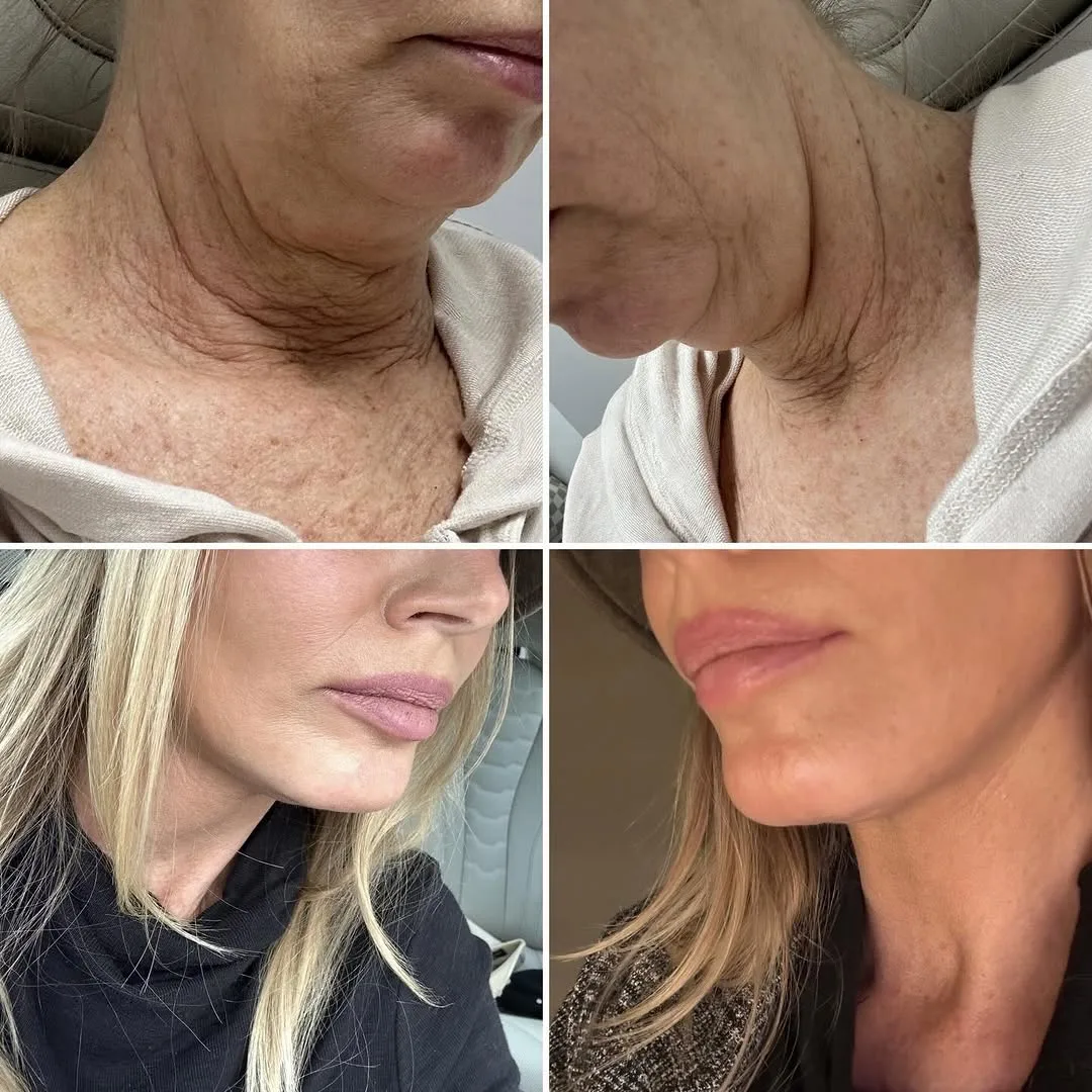 Before and after — Dr. Bryan Brandon