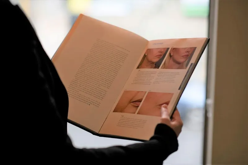 Before and after — Dr. Bryan Mendelson