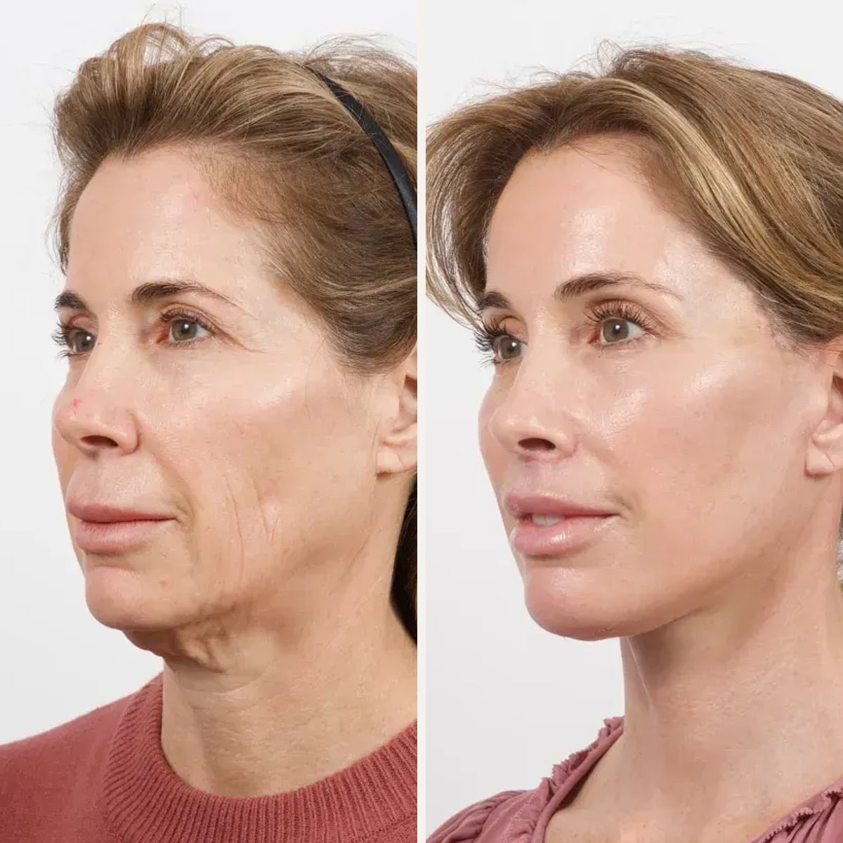 Before and after: Dr. Cameron Brawley