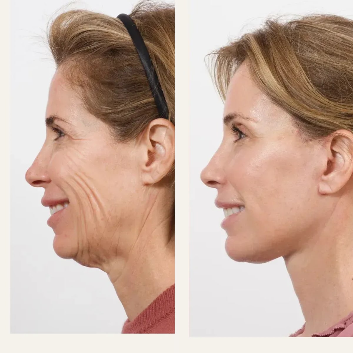 Before and after: Dr. Cameron Brawley
