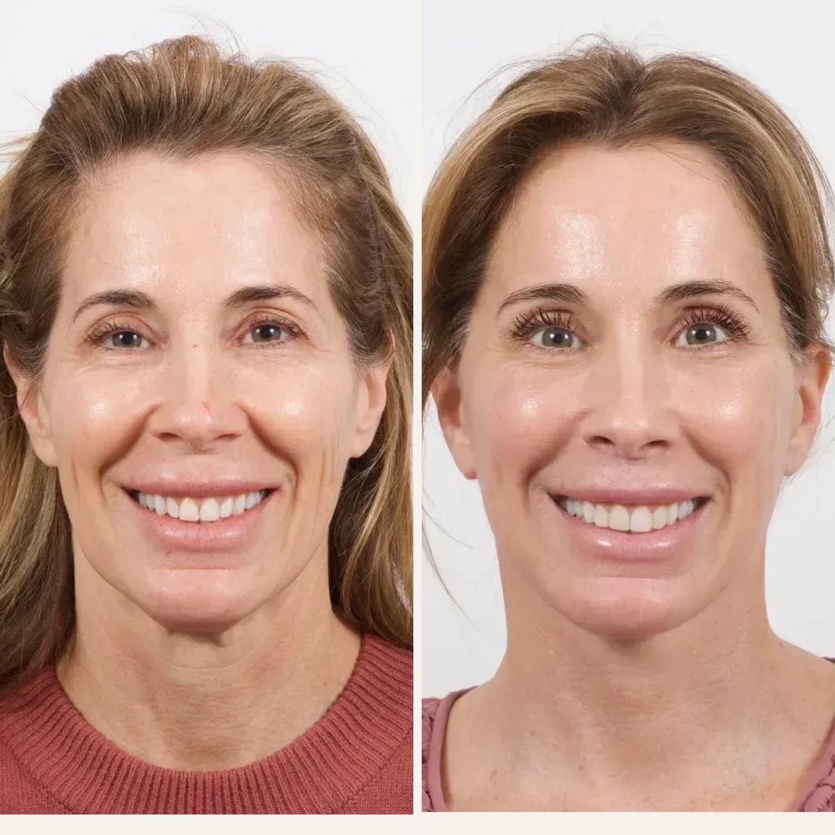 Before and after: Dr. Cameron Brawley