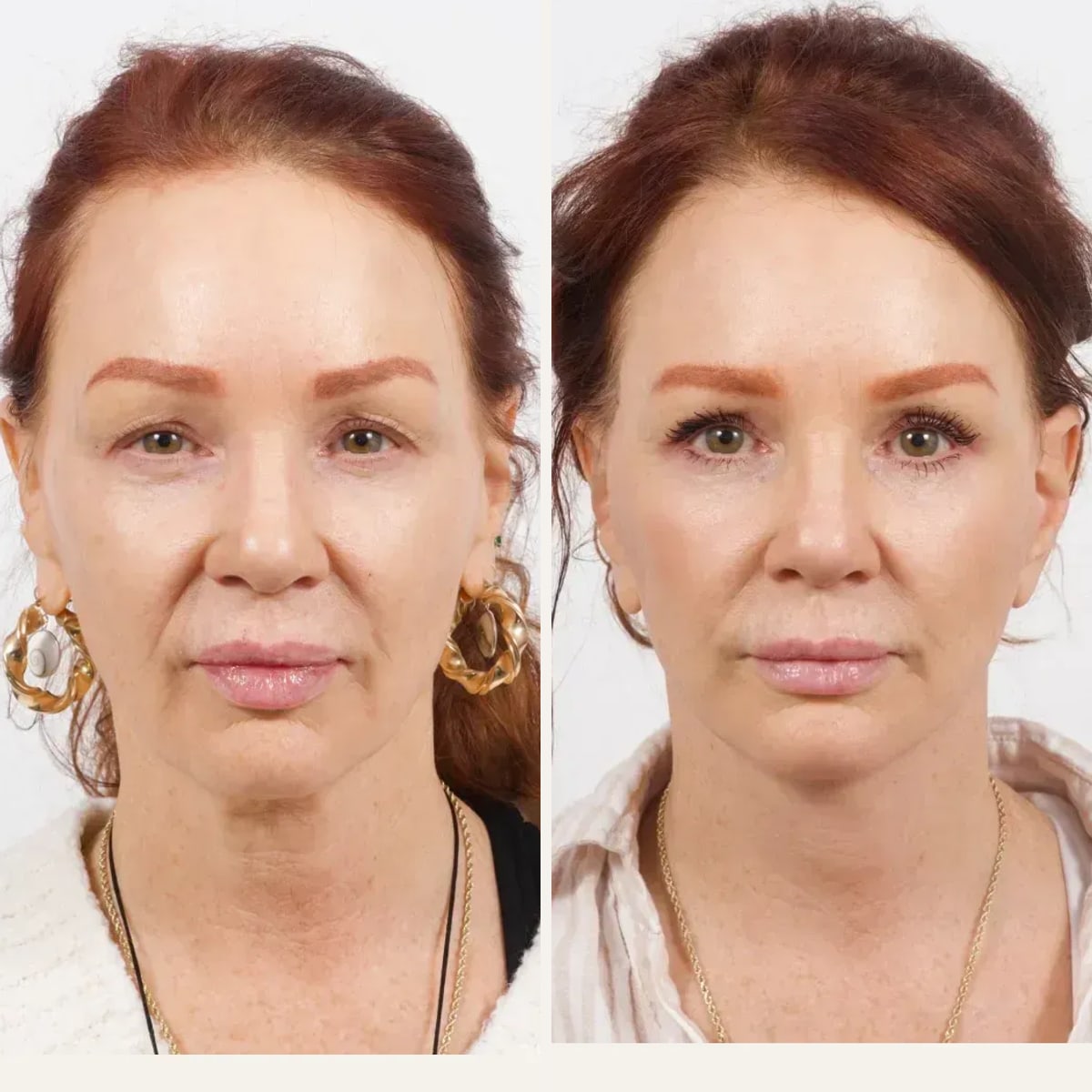 Before and after: Dr. Cameron Brawley