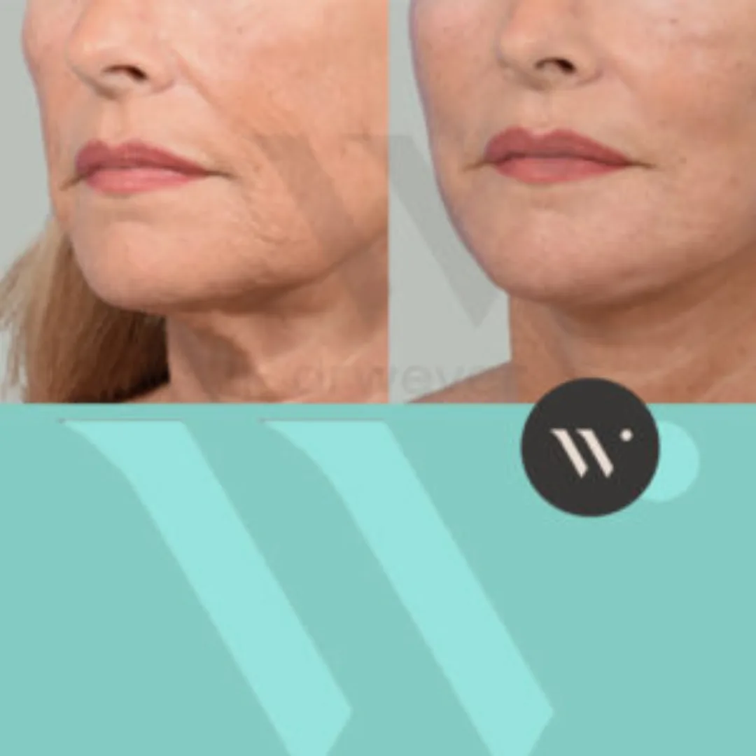 Before and after: Dr. Capi C. Wever