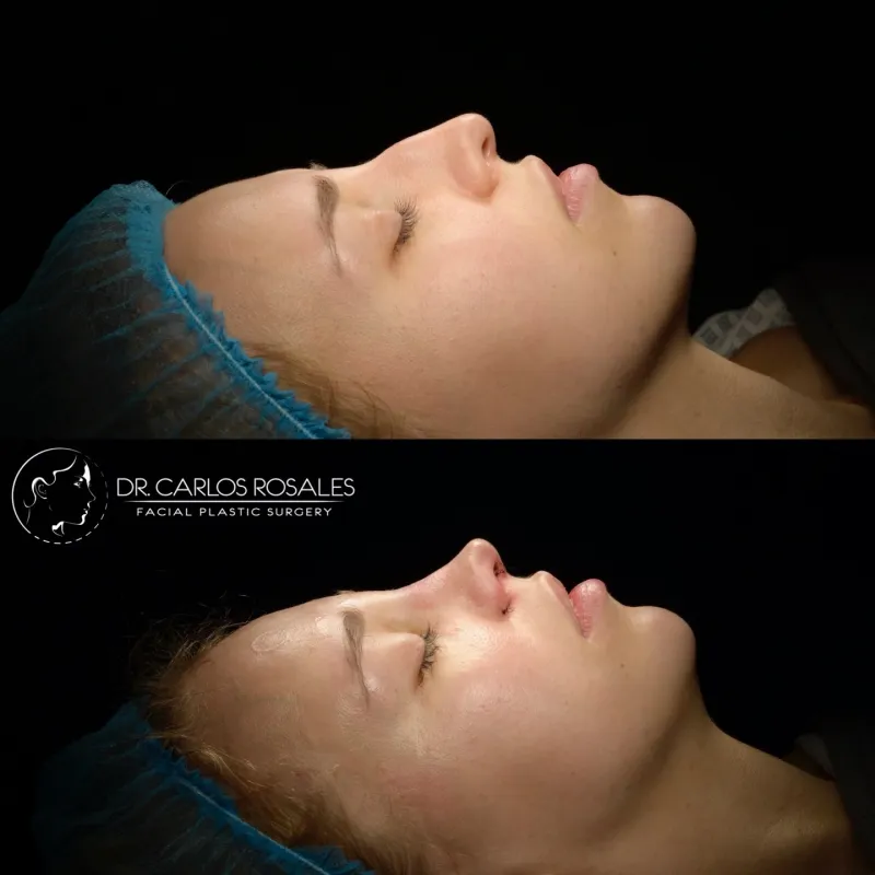 Before and after — Dr. Carlos Rosales