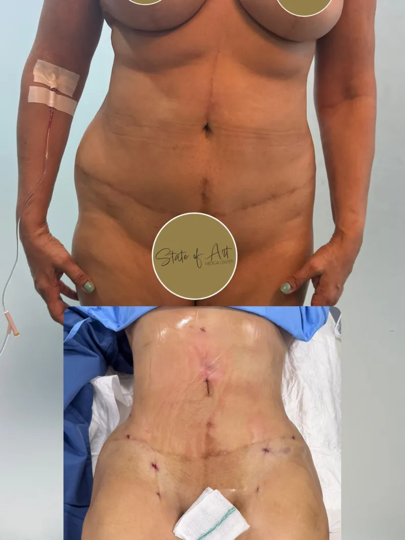 Before and after — Dr. Carlos Vergara