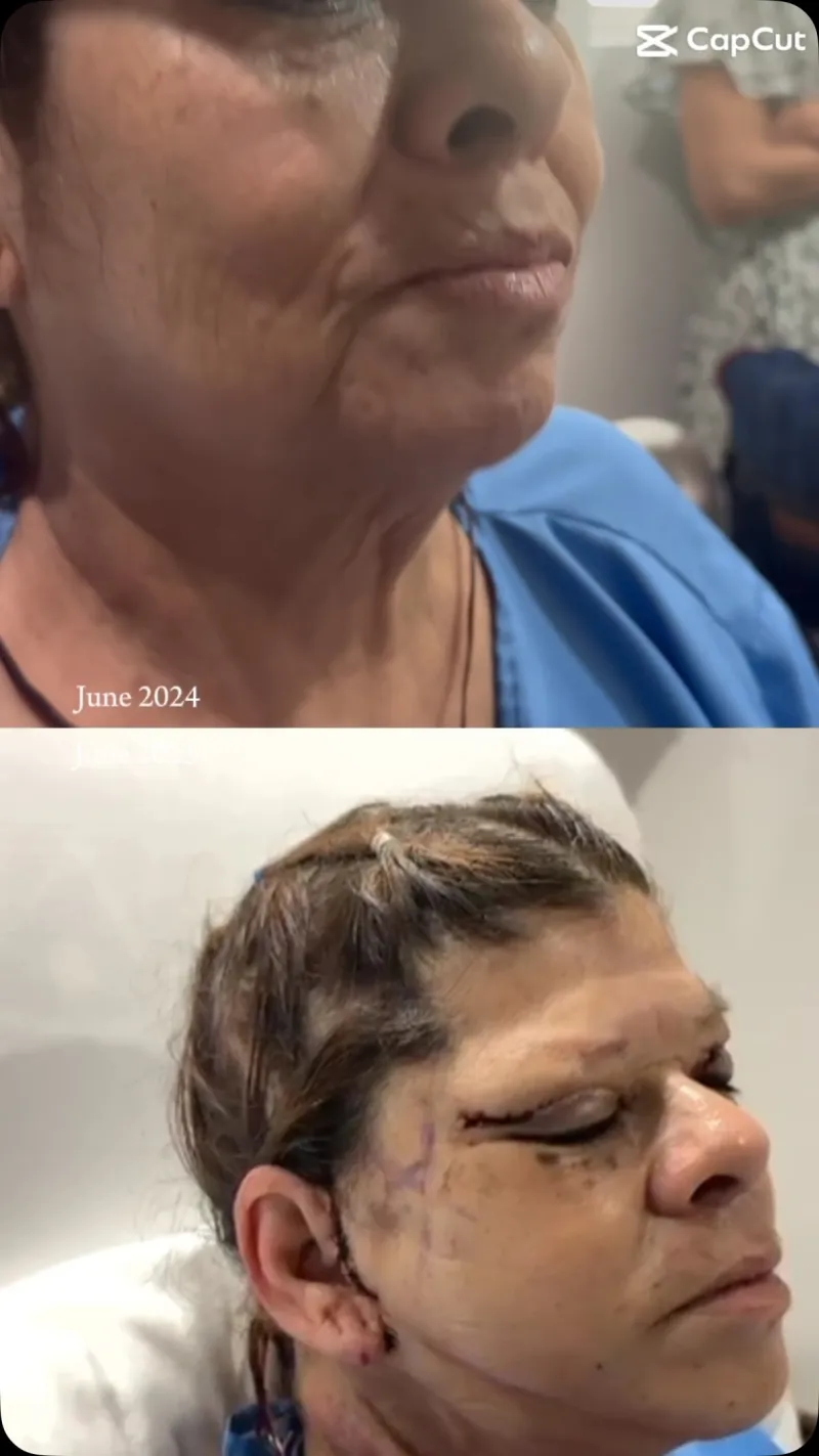 Before and after — Dr. Carlos Vergara