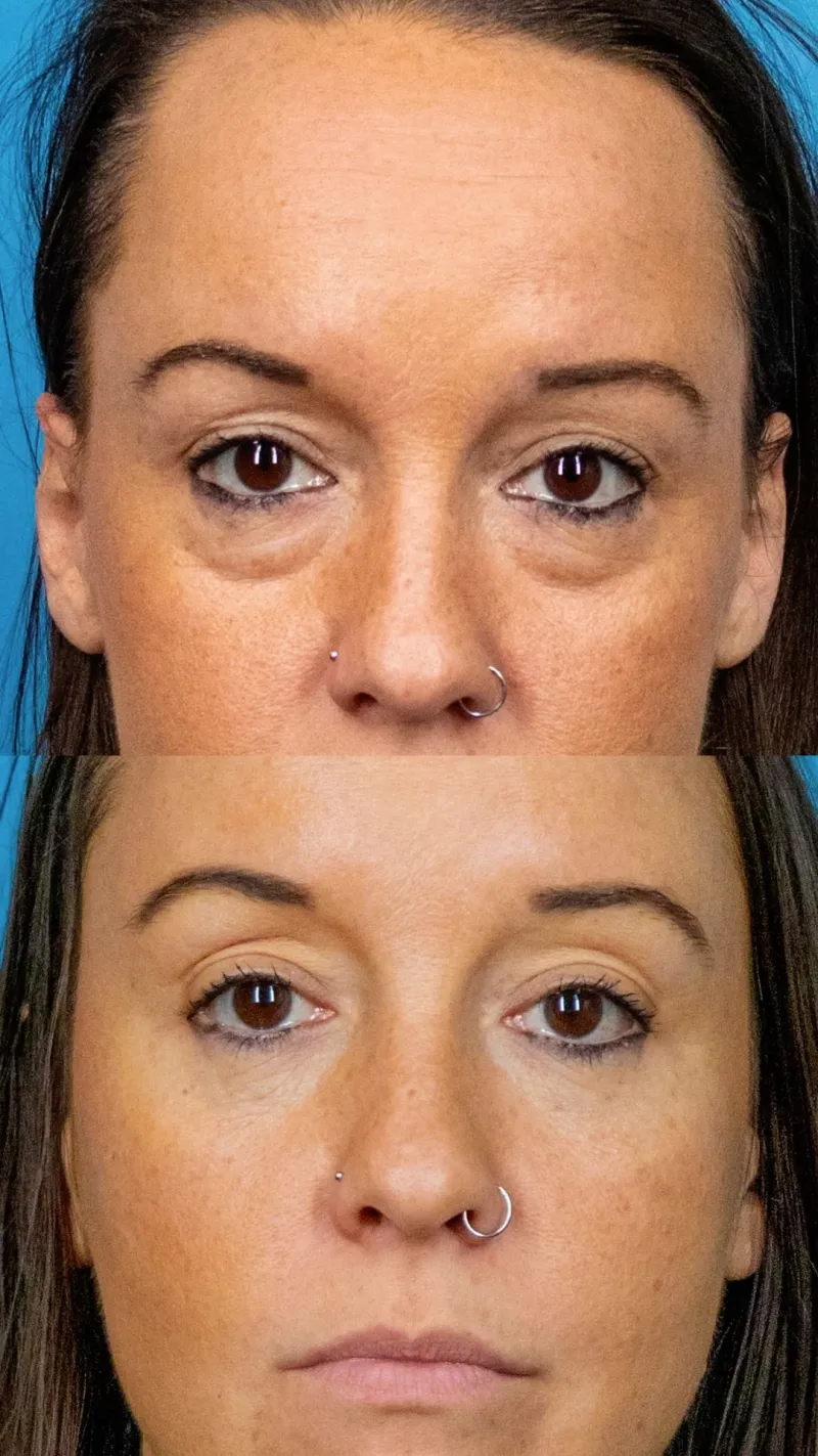 Before and after — Dr. Caroline Hudson