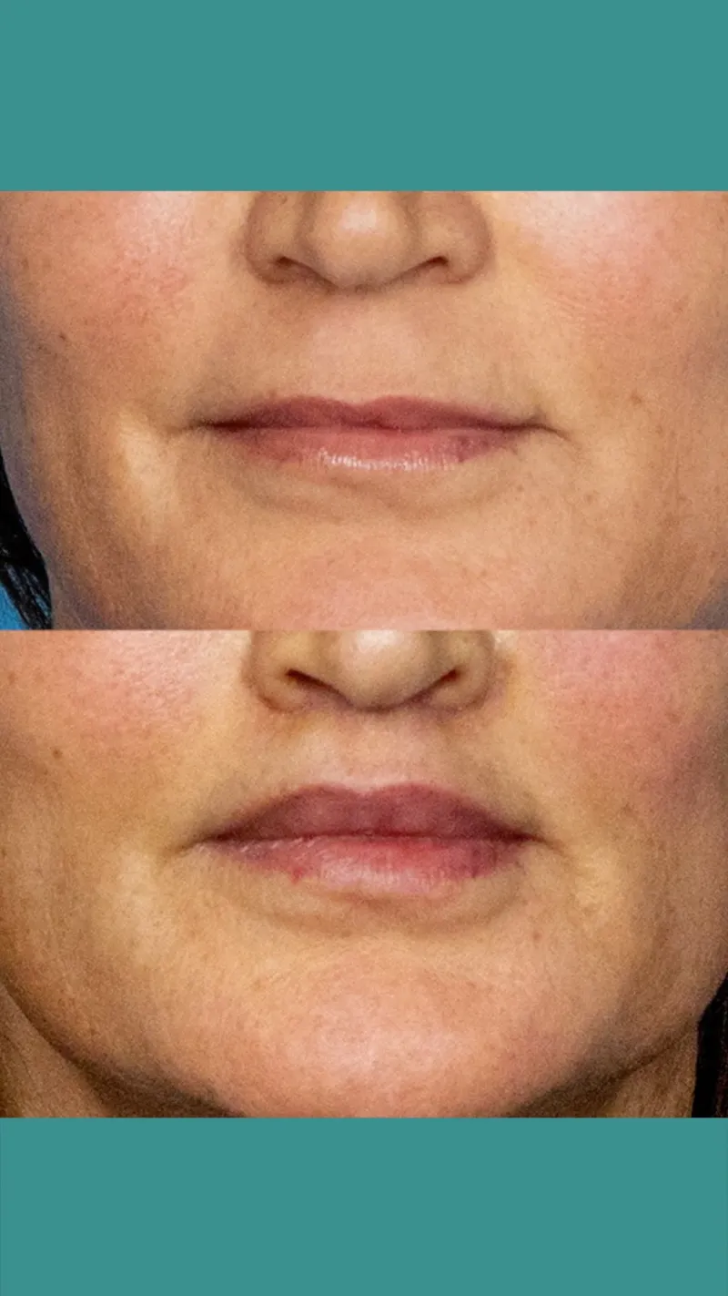 Before and after — Dr. Caroline Hudson