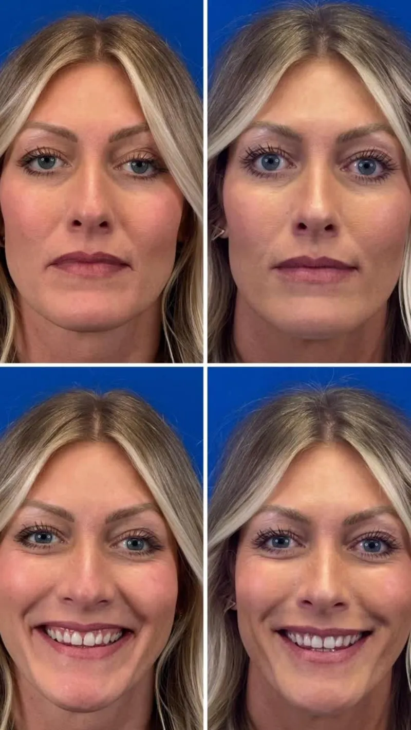 Before and after — Dr. Carolyn Montes