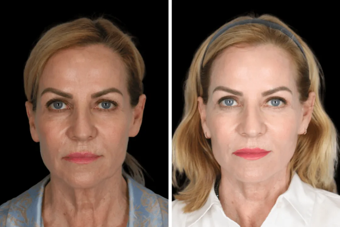 Before and after — Dr. Catherine Chang