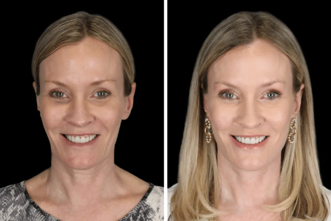 Before and after — Dr. Catherine Chang