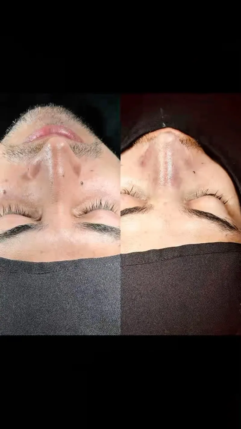 Before and after — Dr. Cesar Martinez