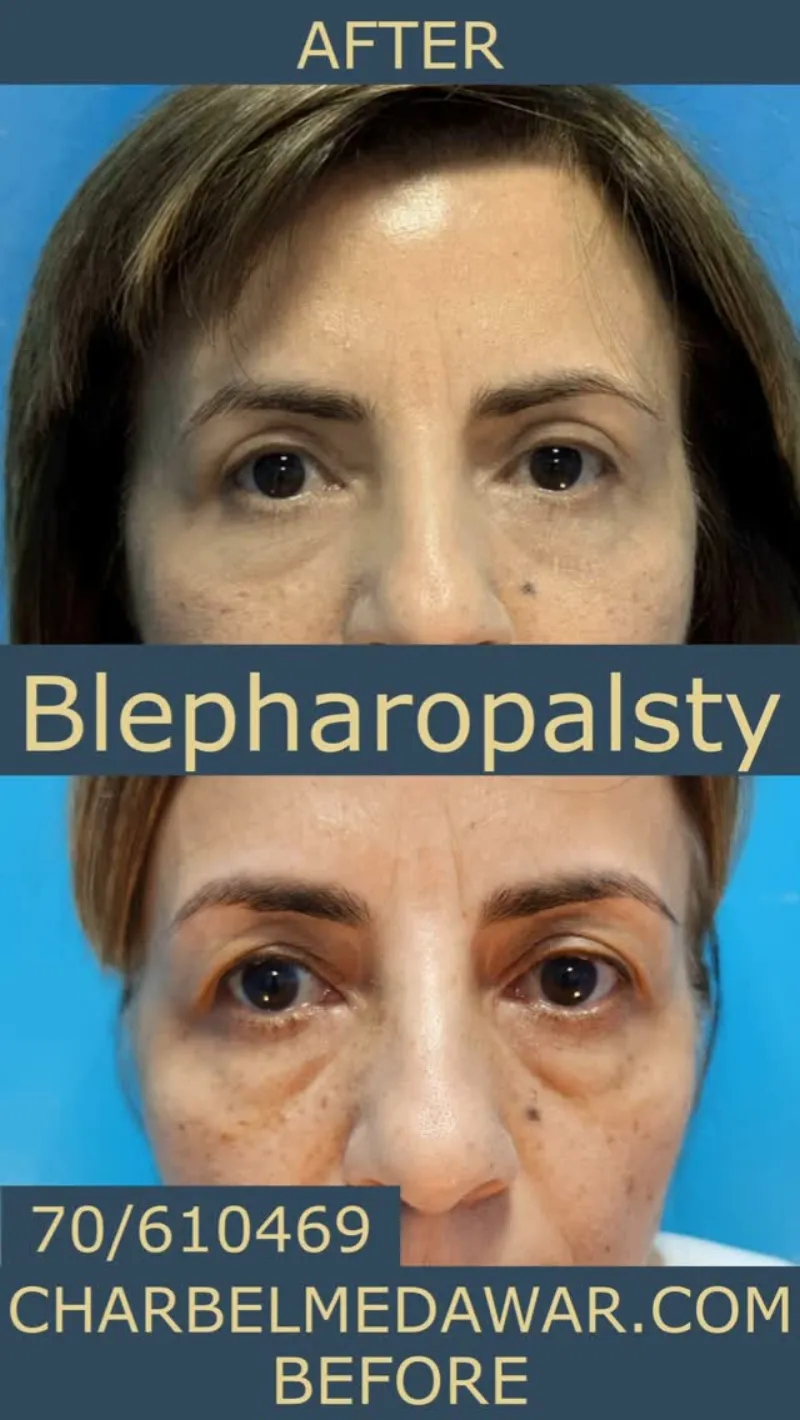 Before and after: Dr. Charbel Medawar