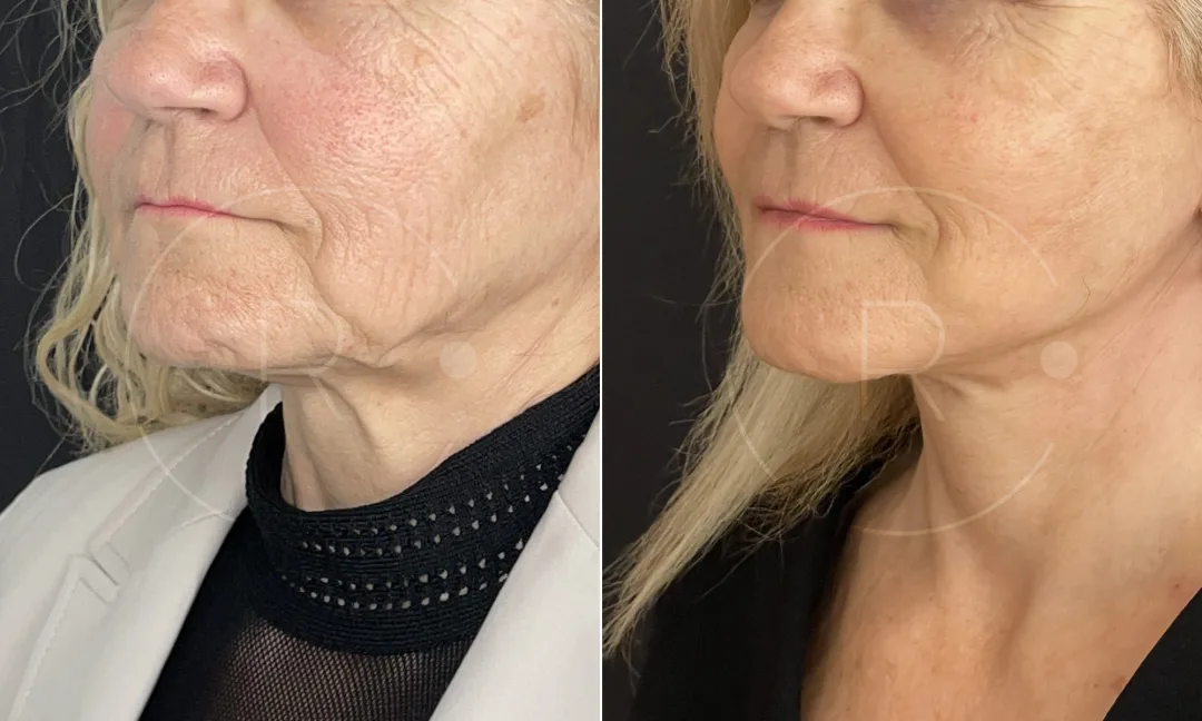 Before and after — Dr. Christophe Reinbold