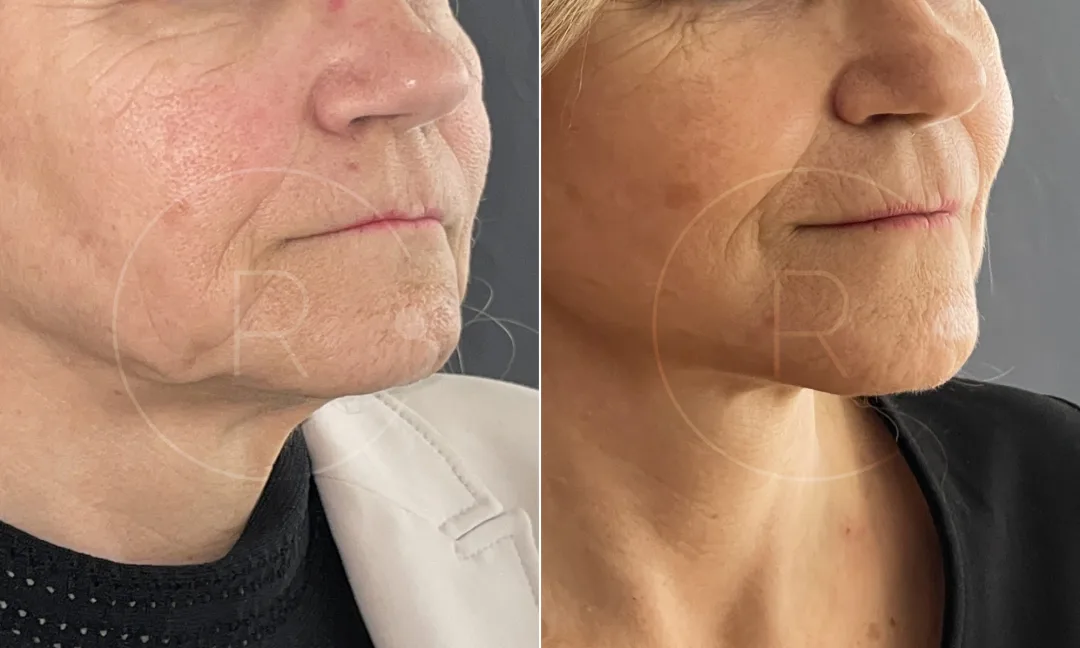 Before and after — Dr. Christophe Reinbold