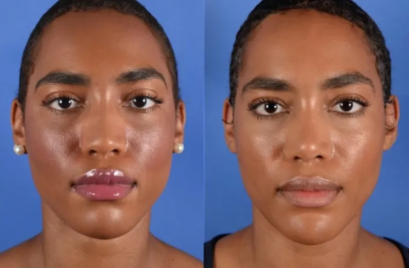 Before and after — Dr. Christopher Cote