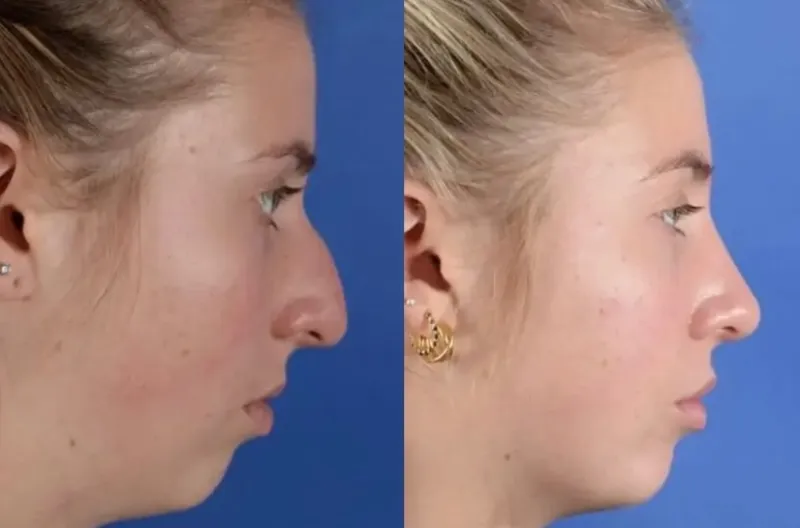 Before and after — Dr. Christopher Cote
