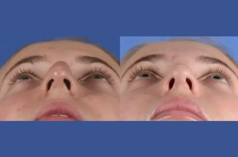 Before and after — Dr. Christopher Cote