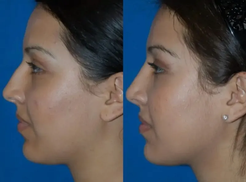 Before and after — Dr. Christopher Cote