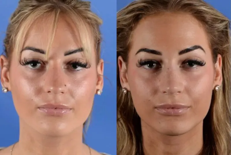 Before and after — Dr. Christopher Cote
