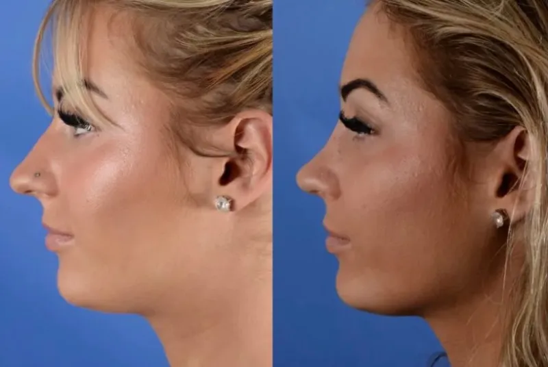 Before and after — Dr. Christopher Cote