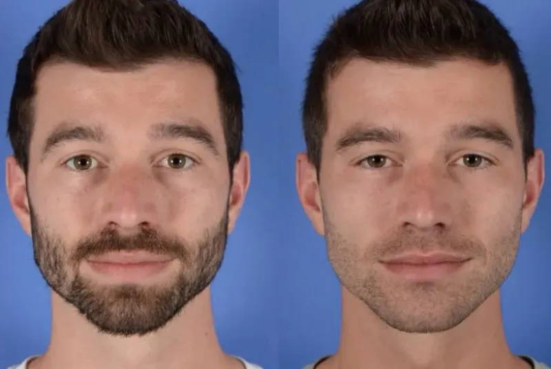 Before and after — Dr. Christopher Cote