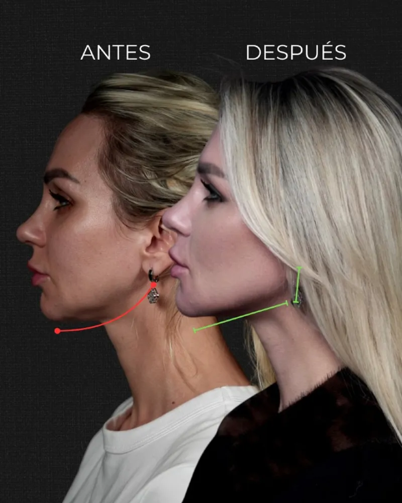 Before and after — Dr. Cristina Muñoz-Gonzalez