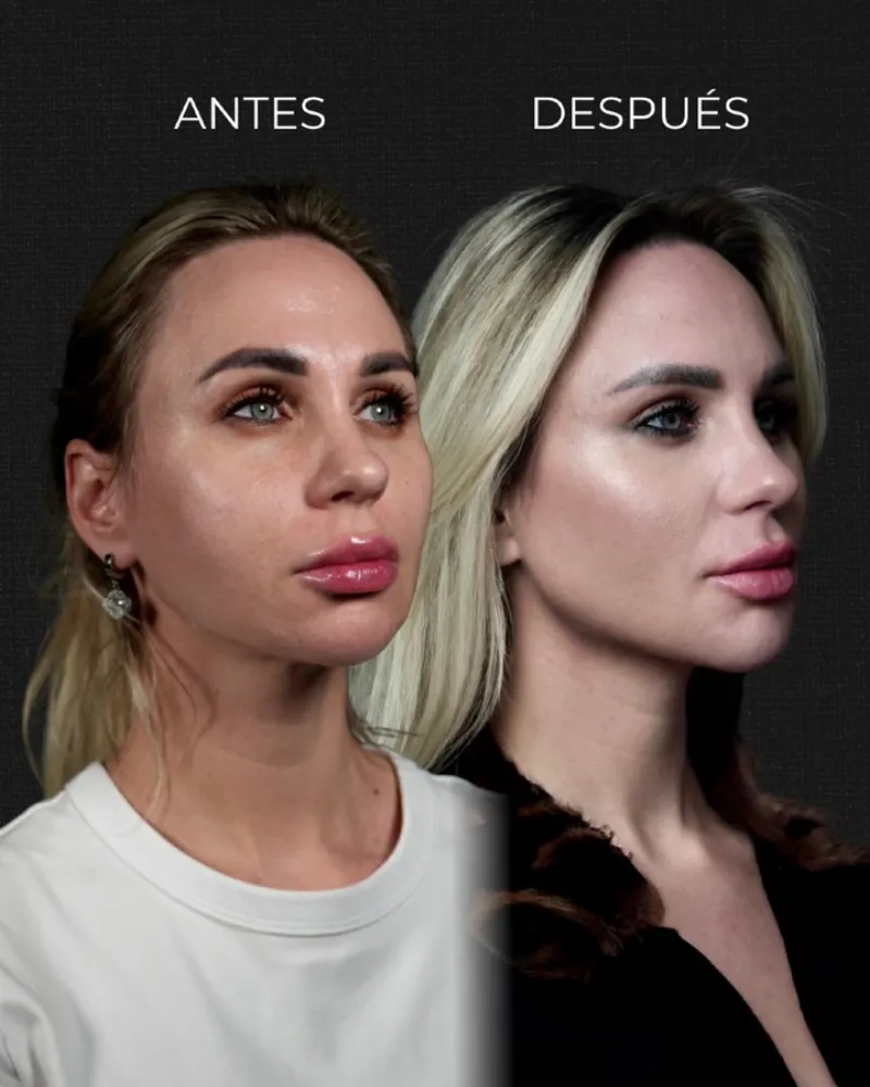 Before and after — Dr. Cristina Muñoz-Gonzalez