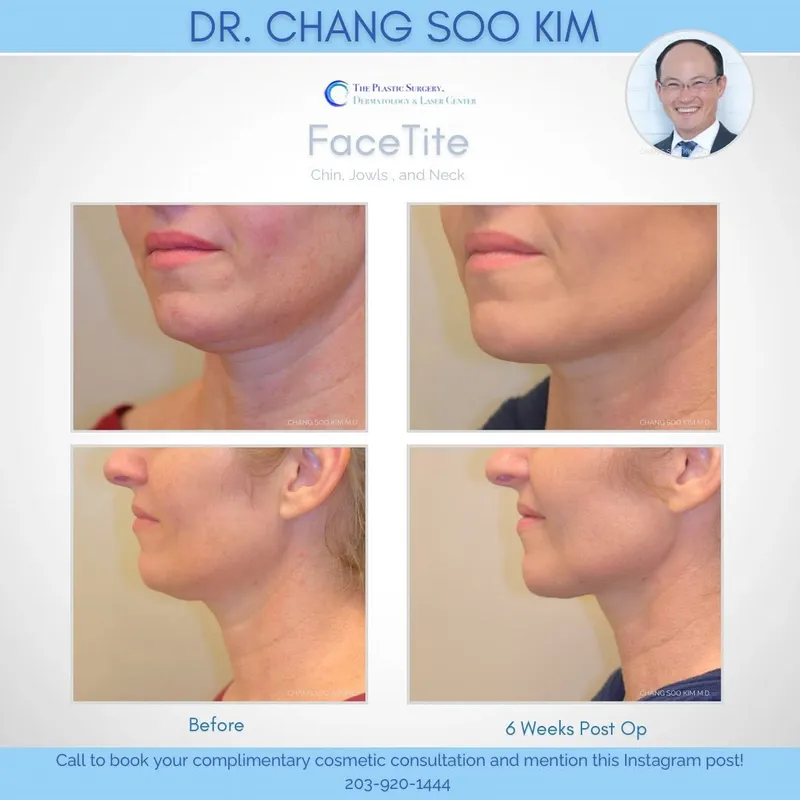 Before and after — Dr. CS Kim