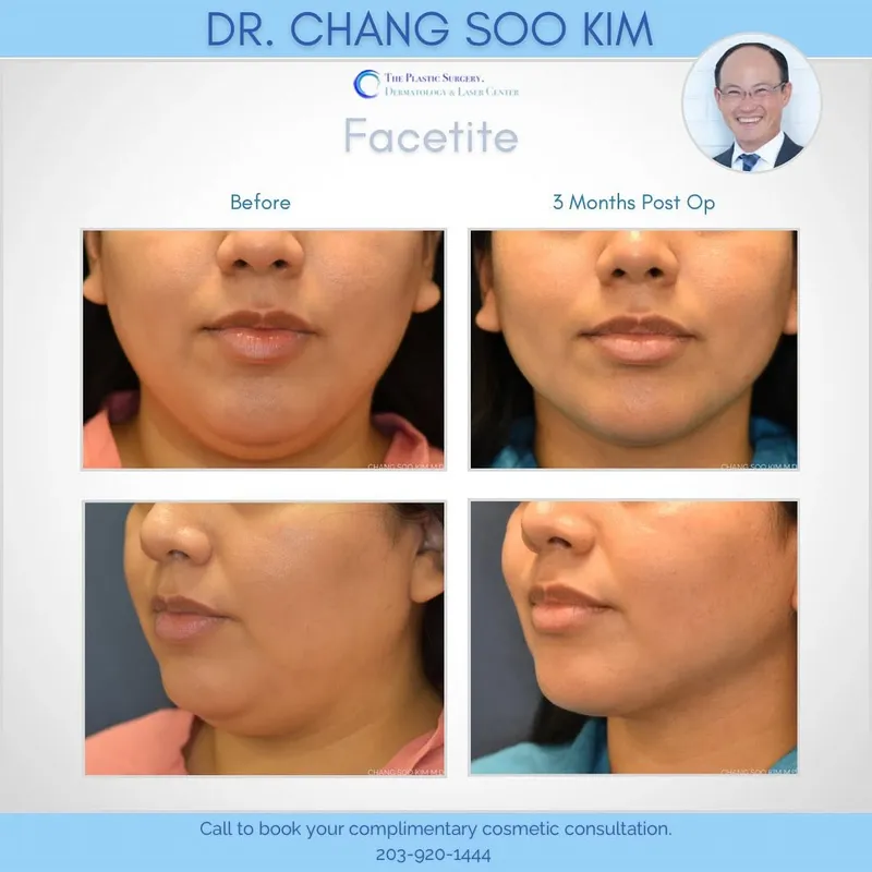 Before and after — Dr. CS Kim