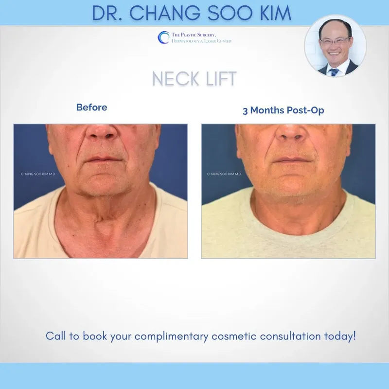 Before and after — Dr. CS Kim