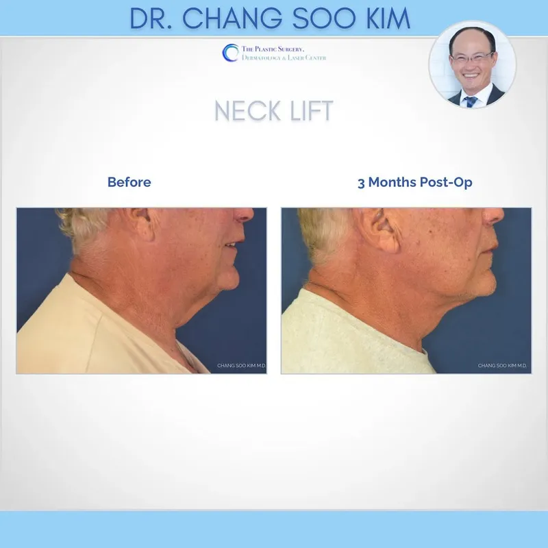 Before and after — Dr. CS Kim