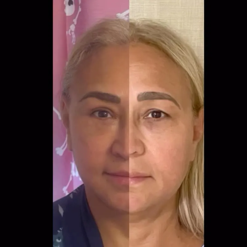 Before and after — Dr. Dağhan Işık
