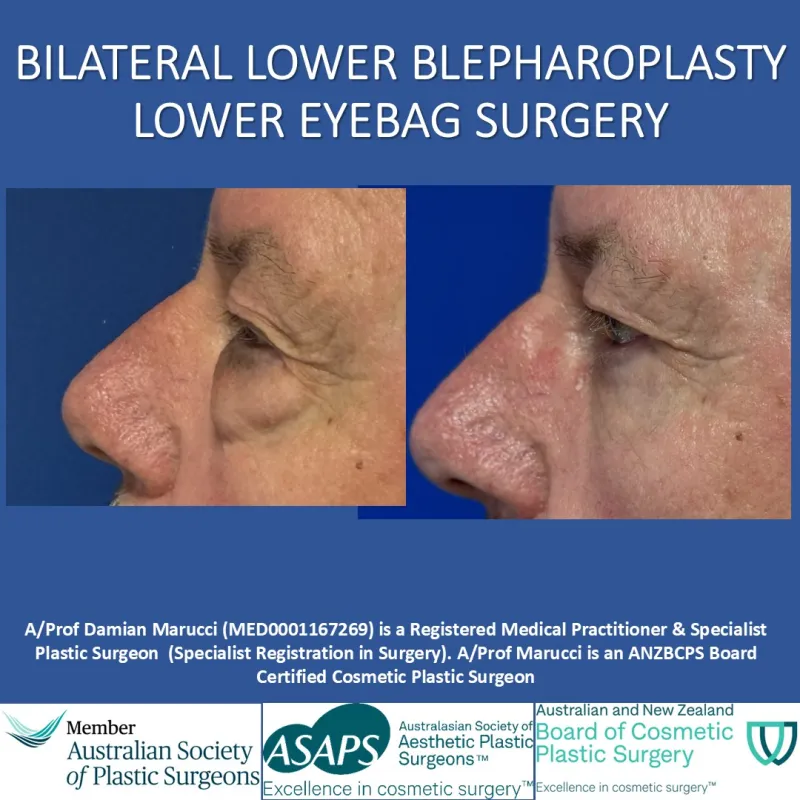 Before and after: Dr. Damian Marucci