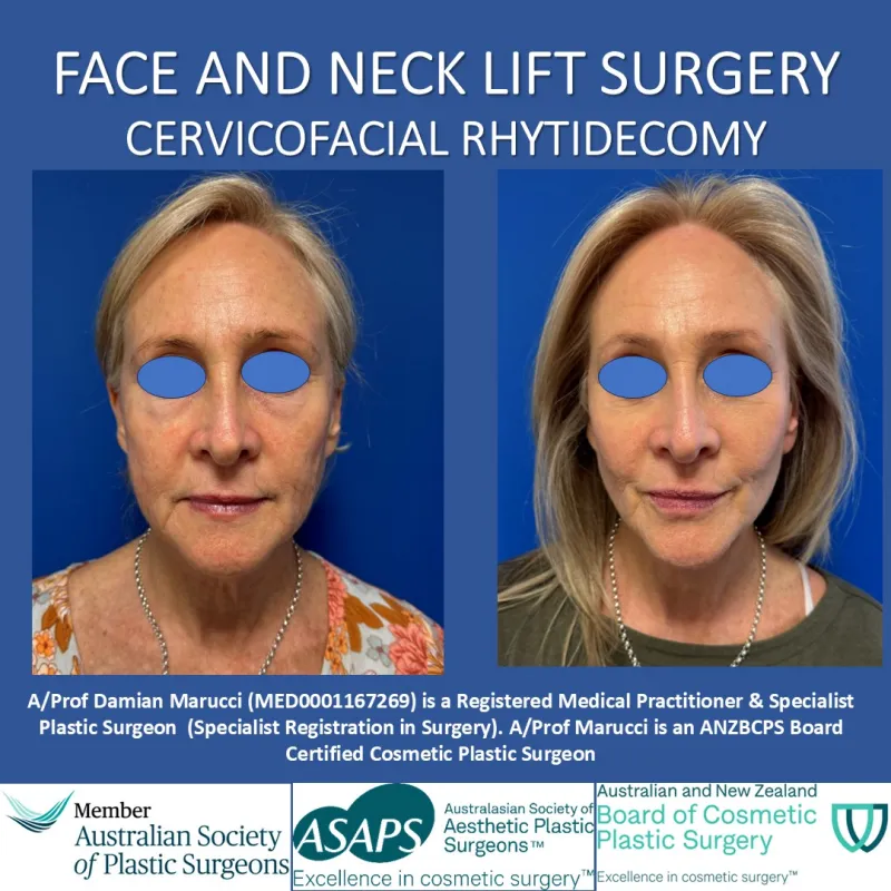 Before and after: Dr. Damian Marucci