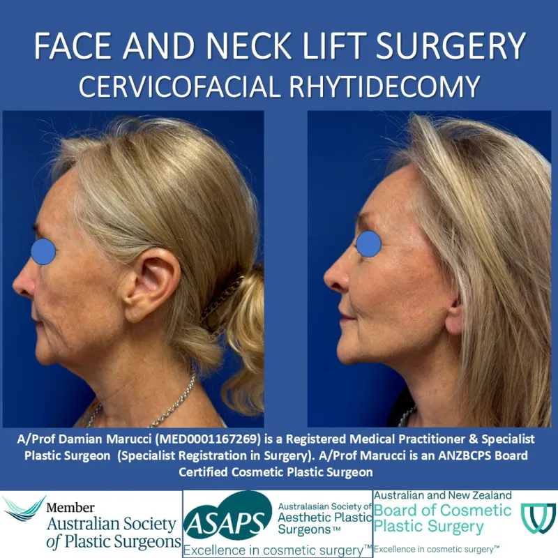 Before and after: Dr. Damian Marucci