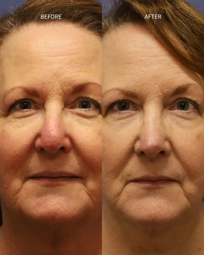 Before and after: Dr. Daniel Bortnick
