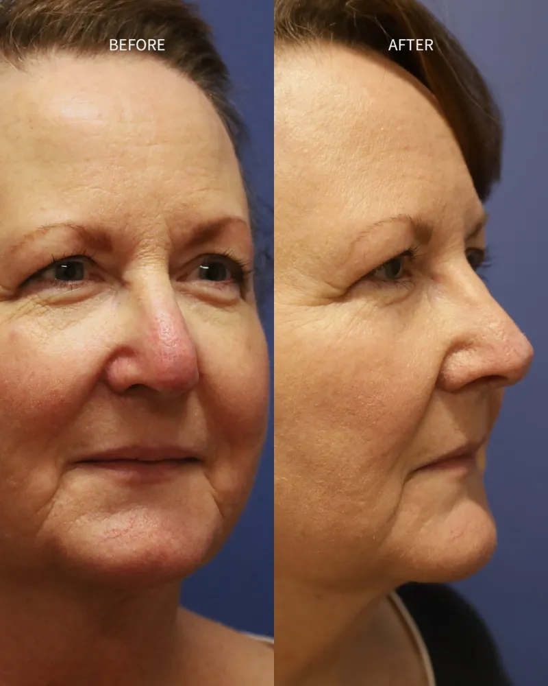 Before and after: Dr. Daniel Bortnick